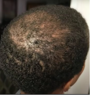 After using Batana Product product